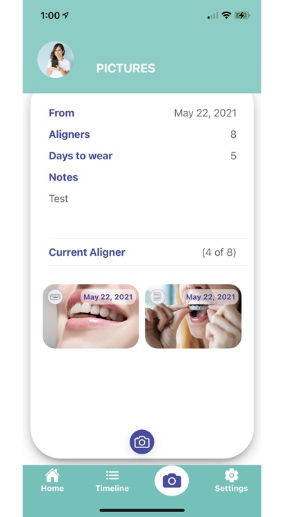 Dr. Aligners App