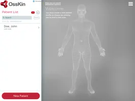 Game screenshot OssKin 3D Scan apk
