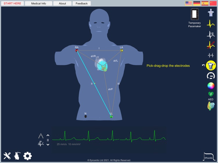 Epicardio Heart Simulator