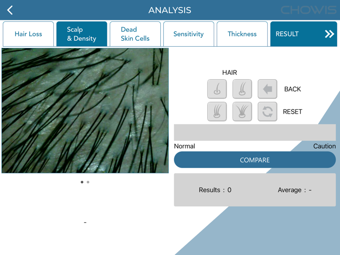 Chowis Hair Analyzer 2