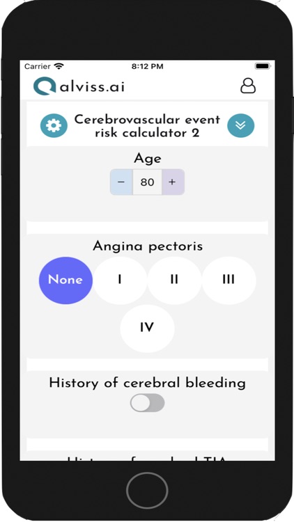 CVE risk calculator 2