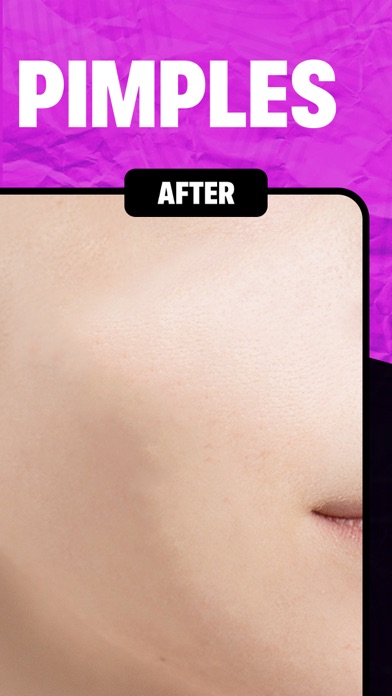 Remove Object & Erase Pimplesのおすすめ画像6