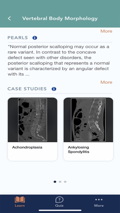 CTisus L-Spine Pathology screenshot-3