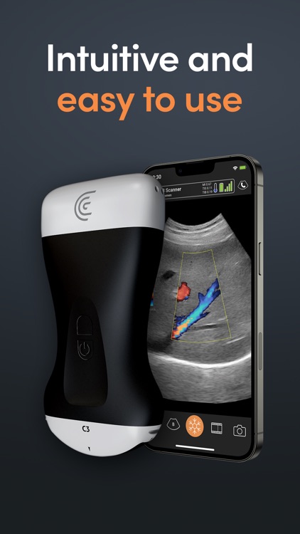 Clarius Ultrasound App screenshot-0