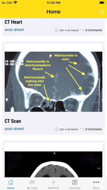 ACCESS - Cerebrovascular App